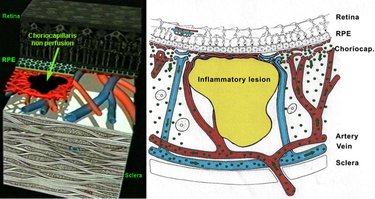 Fig. 12