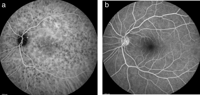 Fig. 23