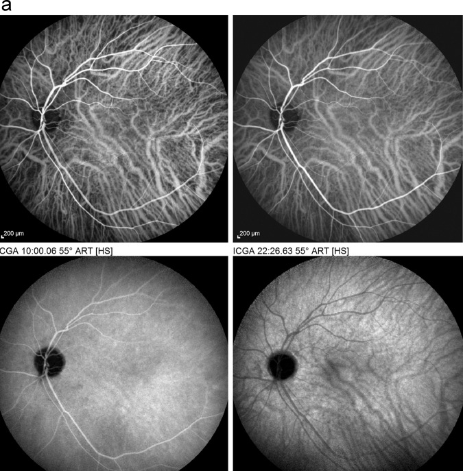 Fig. 10