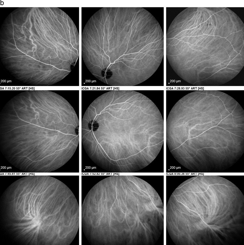 Fig. 10