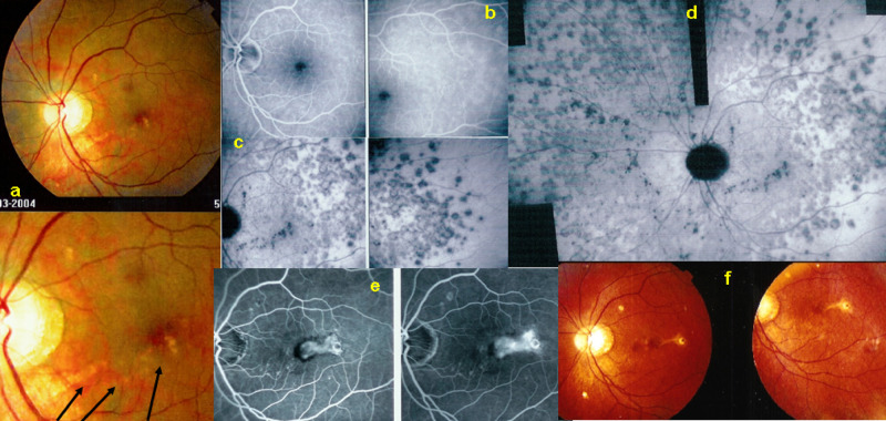 Fig. 20