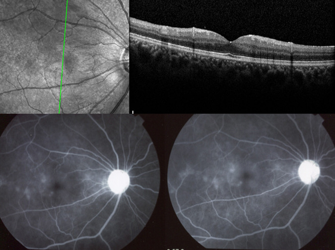 Fig. 3