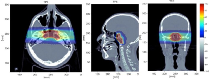 Figure 13