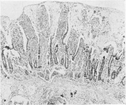 FIG. 7