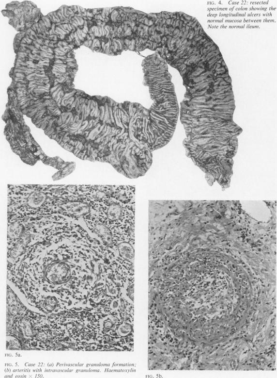 FIG. 4 and FIG. 5