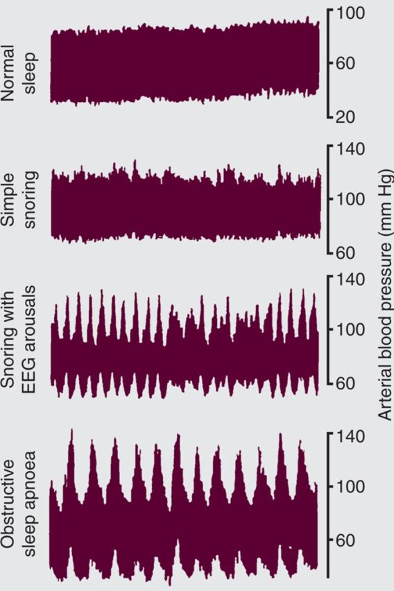 Fig 1.