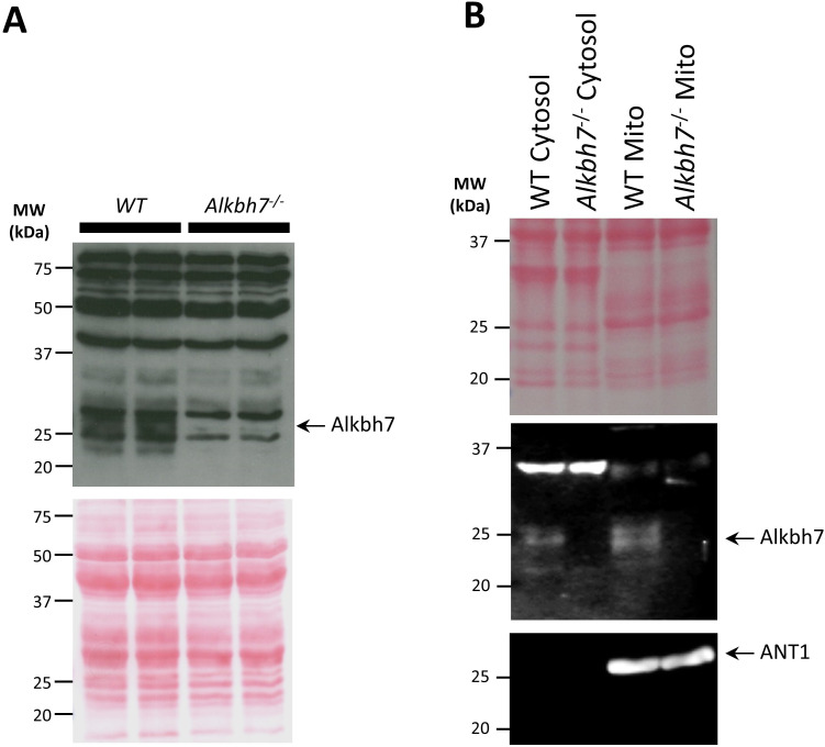 Figure 1—figure supplement 1.