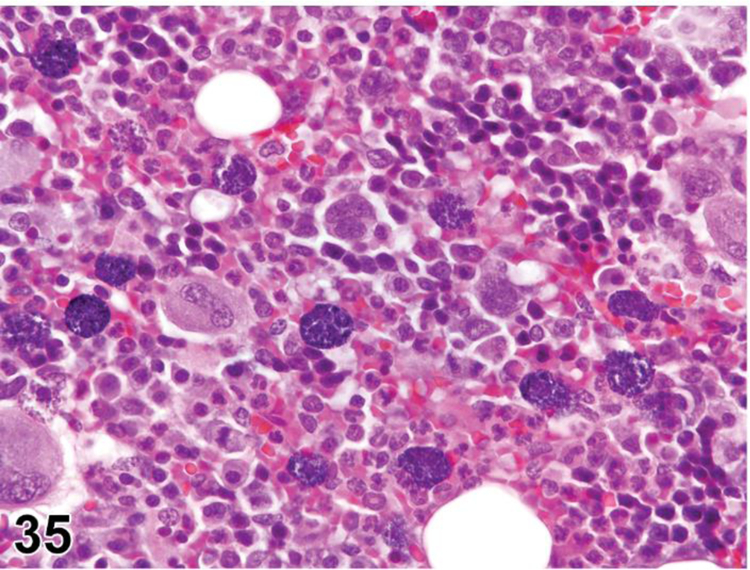 Figure 35.