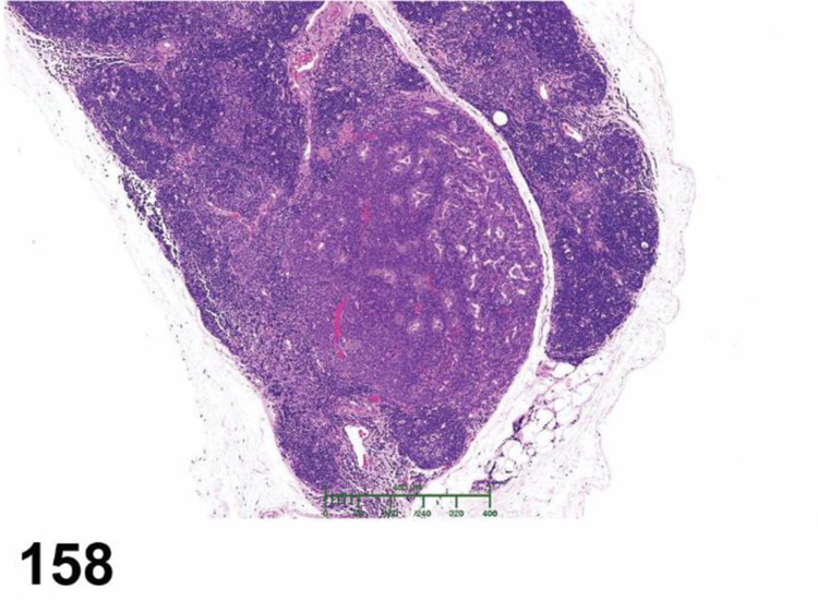 Figure 158.