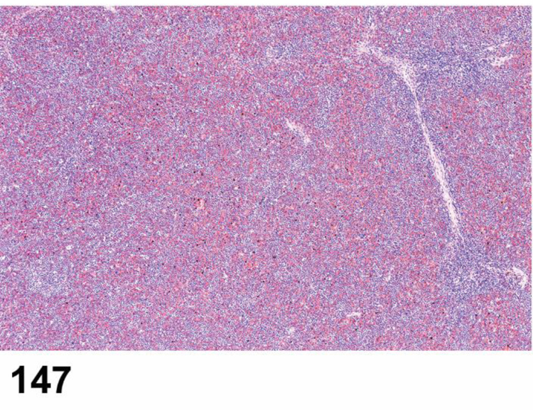 Figure 147.
