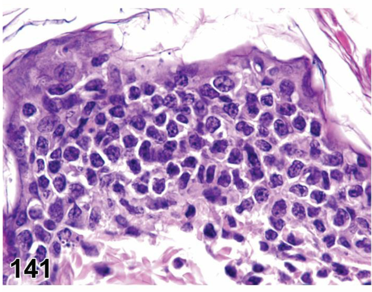 Figure 141.