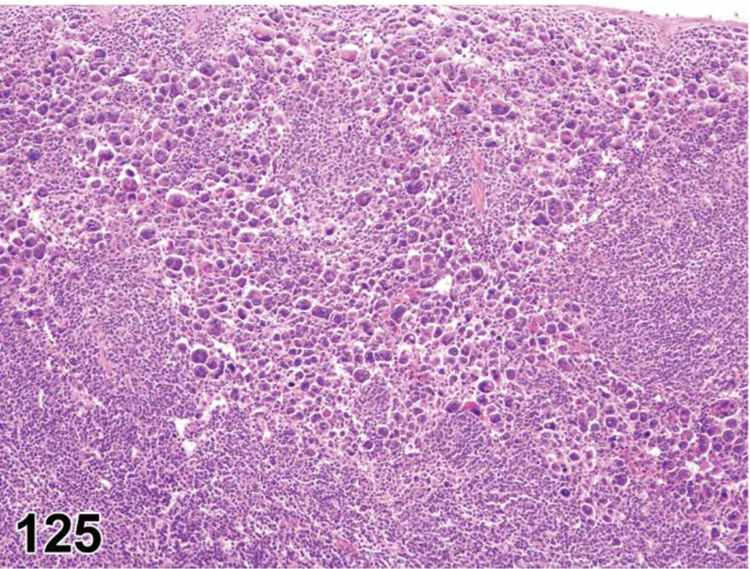 Figure 125.