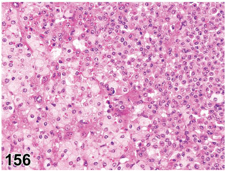 Figure 156.