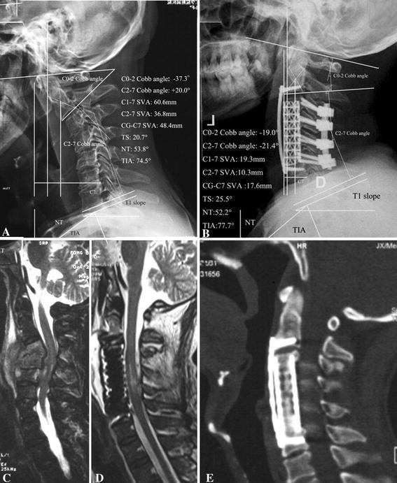 Fig. 1A–E