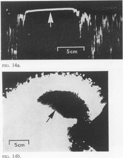 FIG. 14