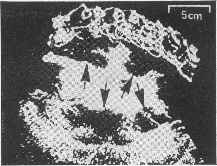 FIG. 16