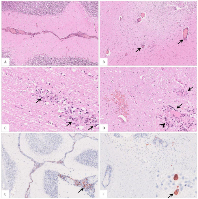 Figure 14