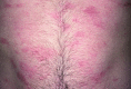 Figure 9.