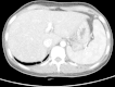 Fig.1