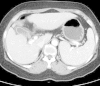 Fig.2