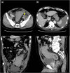 Fig. 1