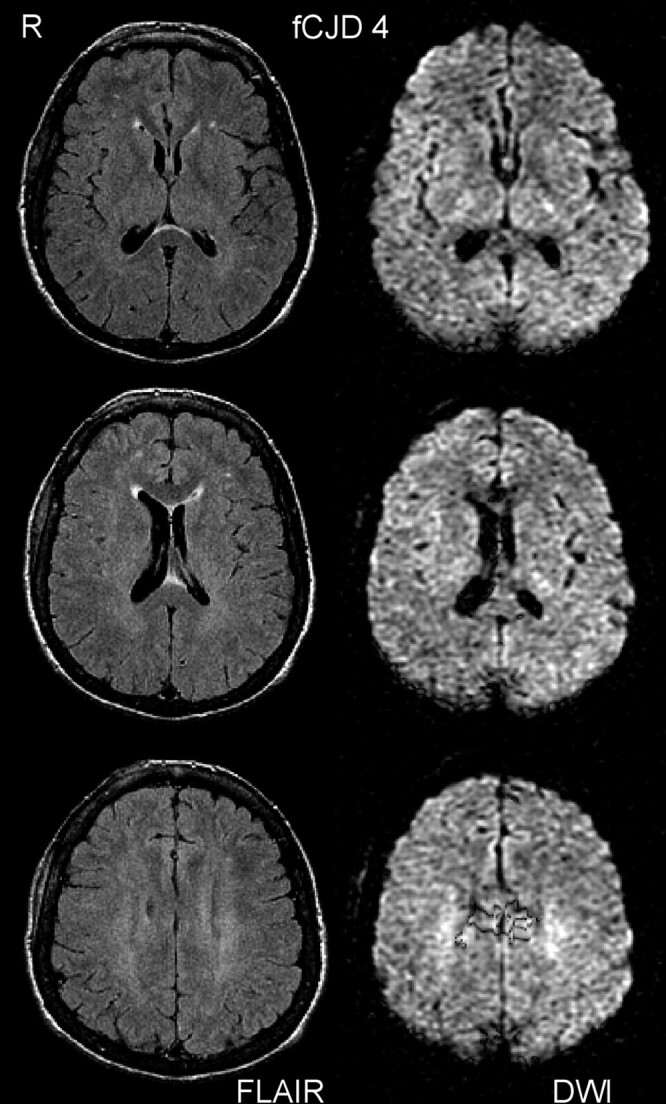 Fig 2.