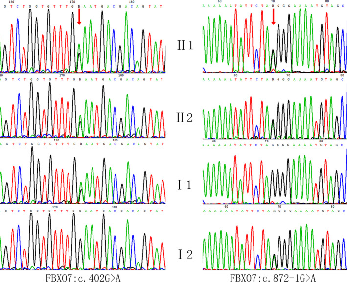 FIGURE 3