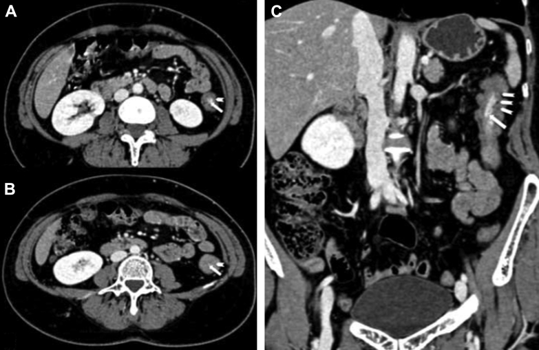 Fig. 1