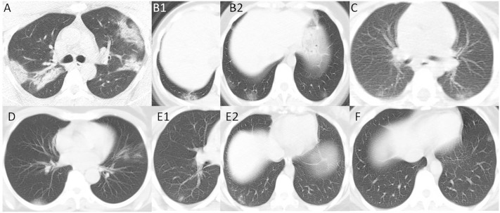 Fig. 2