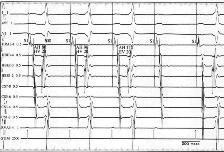 Figure 2