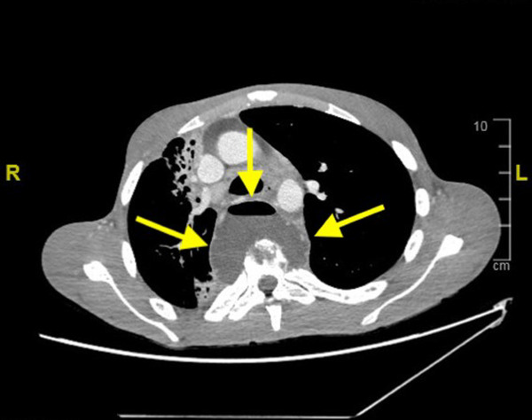 FIGURE 2