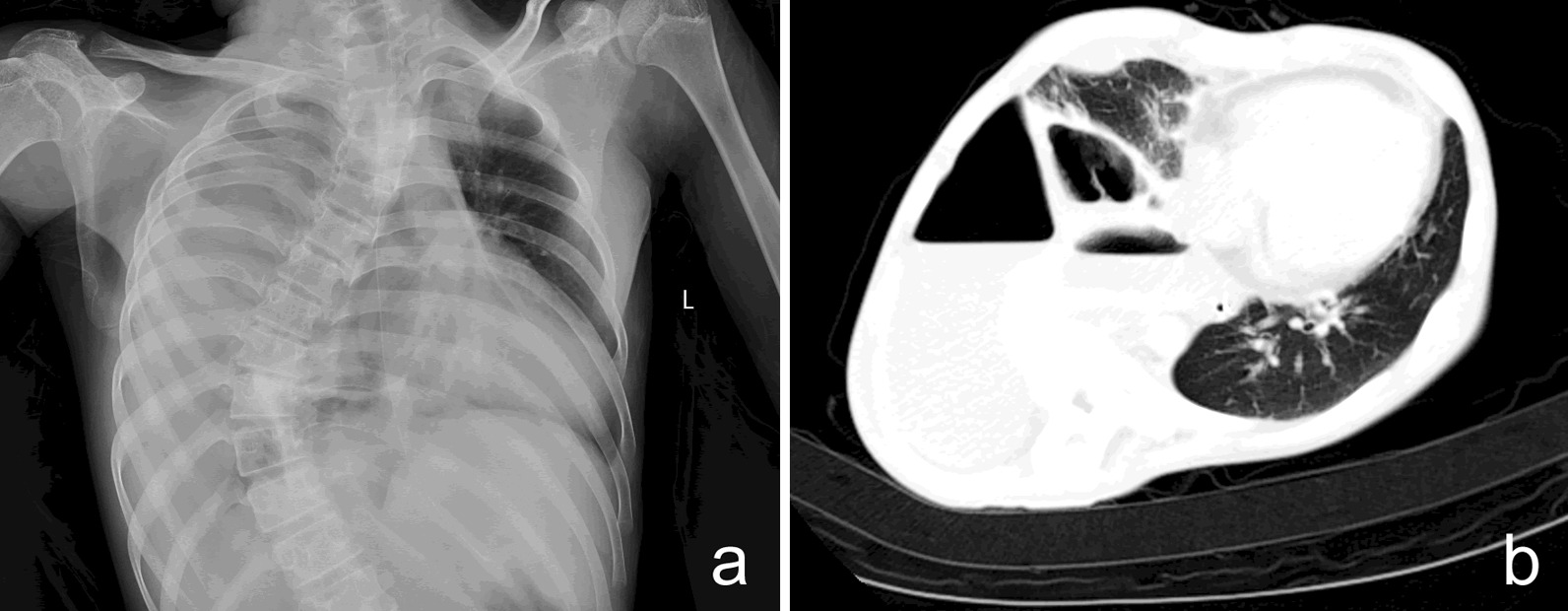 Fig. 1