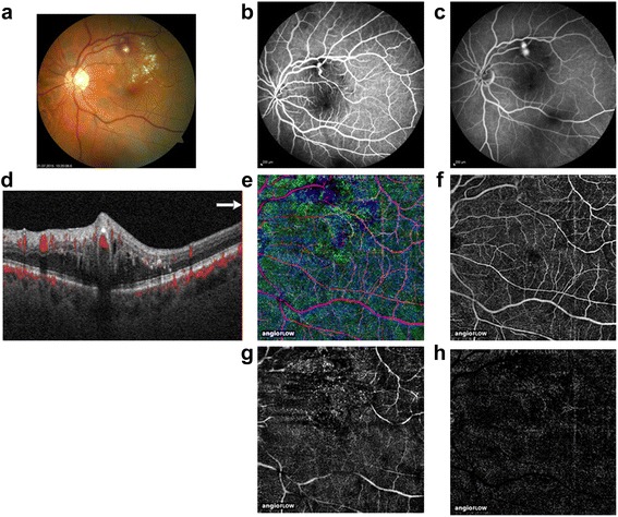 Fig. 3