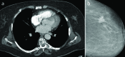 Figure 1. a, b