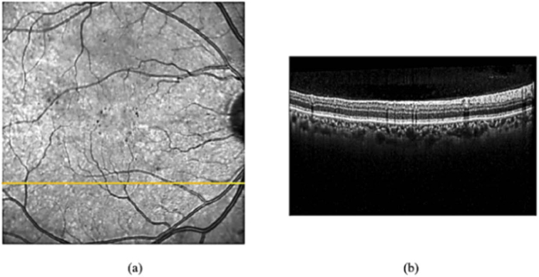 Fig. 2.