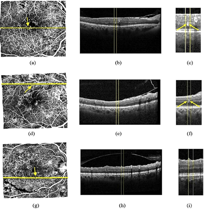 Fig. 15.