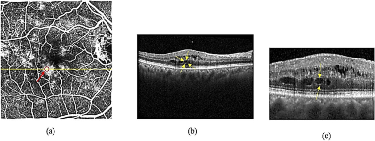 Fig. 16.