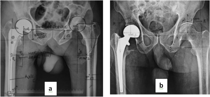 Fig. 1