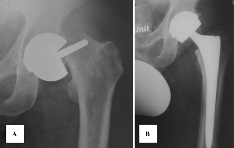 Fig. 2A–B