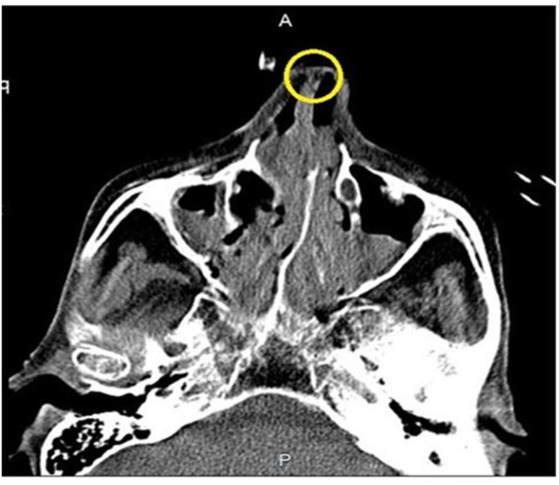 Fig. 2: