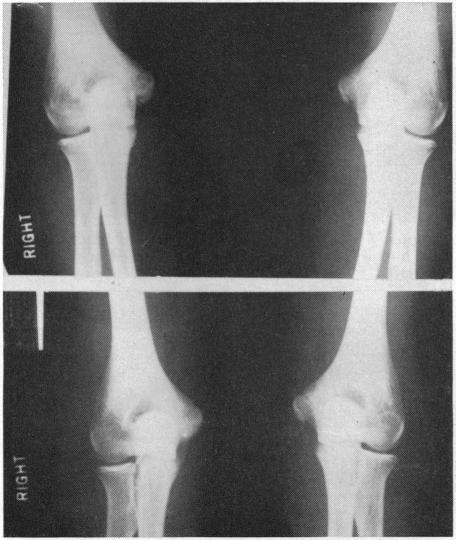 Figure 3 (Case 3).