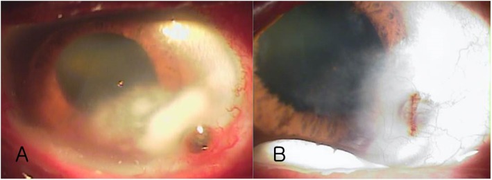 Fig. 10