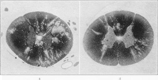 Figs. 4-5