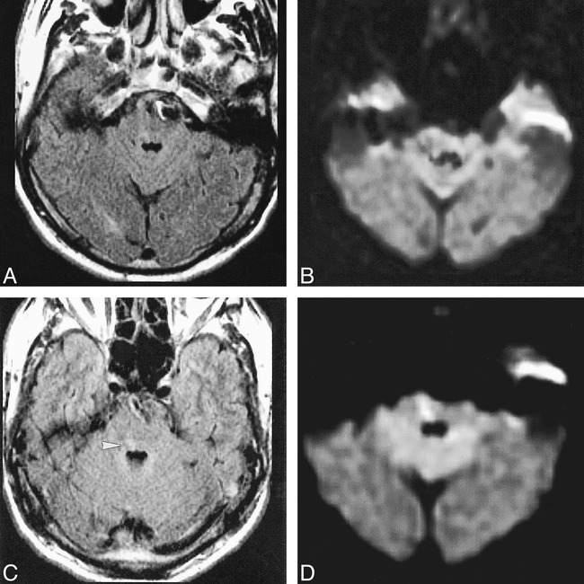 fig 3.