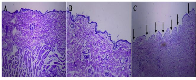 Fig. 12