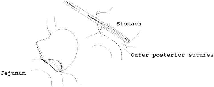 Fig. 16