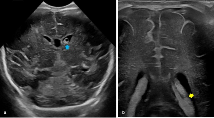 Fig. 4