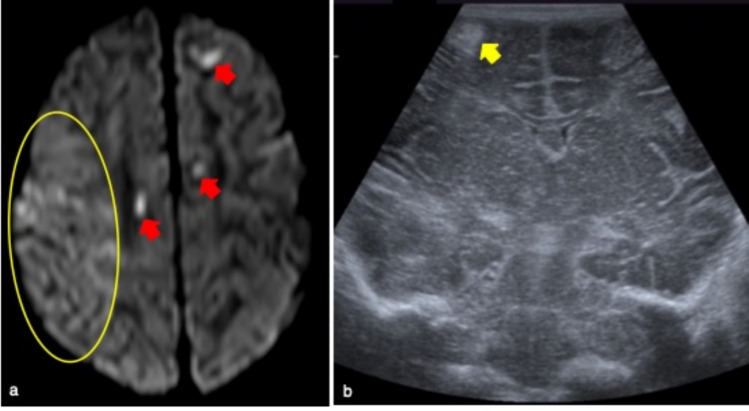 Fig. 10