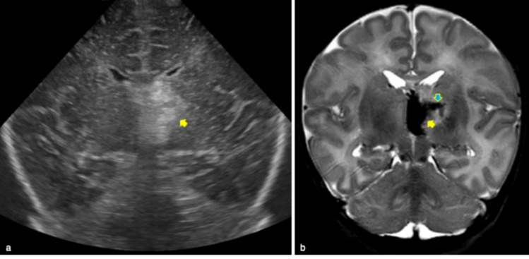 Fig. 13