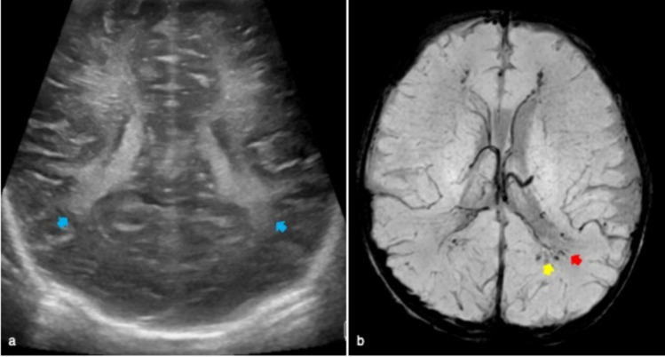 Fig. 12
